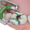 Garrison Composi-Tight®3D Fusion™ MINI KIT