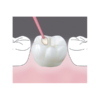 BeautiSealant