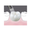 BeautiSealant