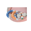 PRSTENOVI3 Asortiman 3 prstena Composi-Tight® 3D Fusion™ (Garrison)