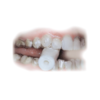 chewies1 Chewies za alignere 2/1