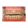 aqua4 Aqualizer Ultra - medium