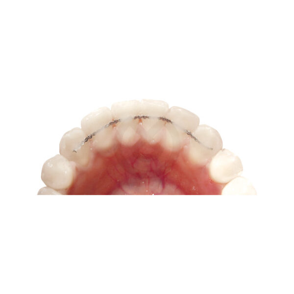 Ortho žica braided